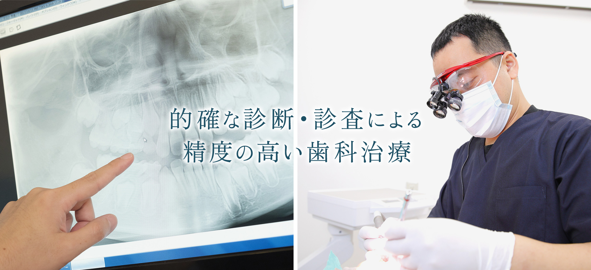 的確な診断・診査による精度の高い歯科治療